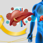 Julho Amarelo: Mês de luta contra as hepatites virais