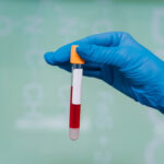 Hemoglobina glicada (HbA1c)