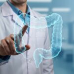 Diagnóstico precoce traz grandes chances de cura ao câncer colorretal